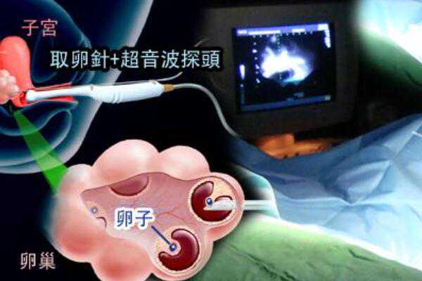 上海红房子医院可以做试管婴儿助孕手术吗？,上海三大助孕机构坤和地址哪里