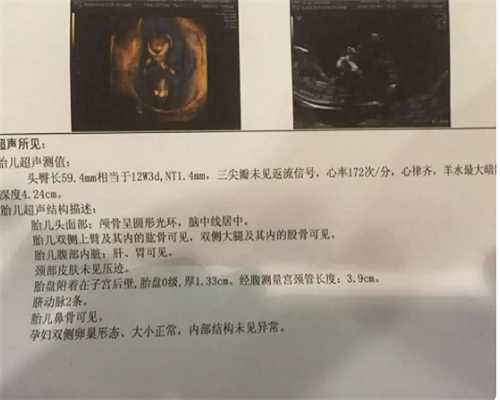 <b>上海代孕公司简介,想知道在上海哪家医院做试管成功率高？</b>