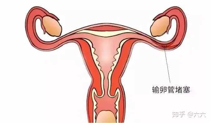 上海有人要助孕的吗知乎,2023上海仁济医院可以做供卵试管婴儿吗?