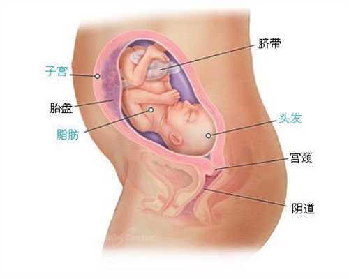 人民日报：不宁腿综合症临床治疗上外贴的助孕