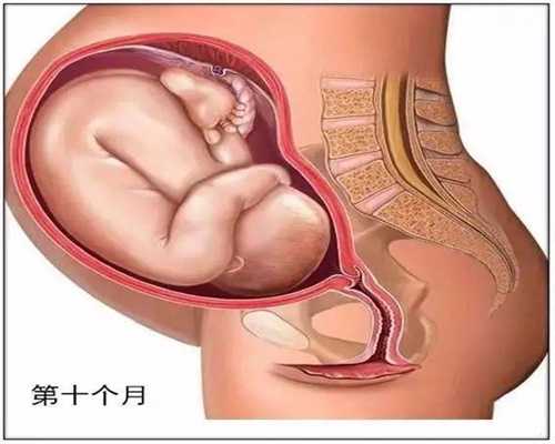 代孕妇有子宫肌瘤是能顺产好 做好预防是关键