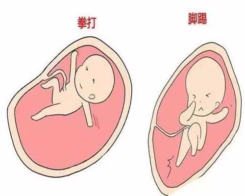广州代孕期间为何手指会发胀