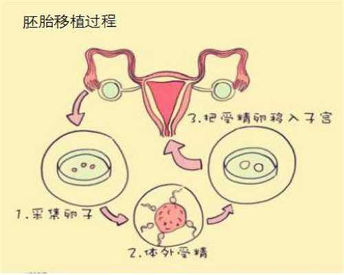避免出现意外 代孕春梦要少做_广州地下助孕