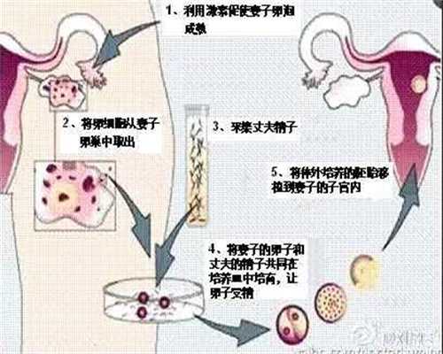 上海代孕是怎么样的_上海代孕生殖专家_经期前一
