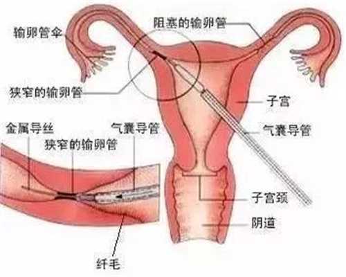 上海助孕选性别包成功_上海梦缘代怀孕地址_孕妇