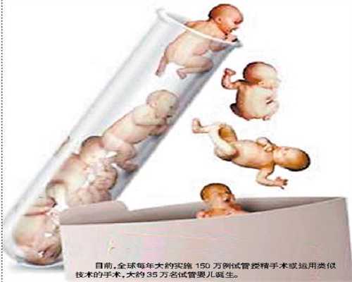 上海代生宝宝网_32周做胎心监护早吗