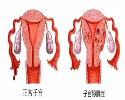 上海代孕代怀孕包成功_上海代孕孩子包性别_孕十二周孕酮还重要吗