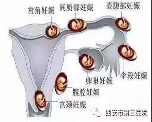 上海代孕生孩子多少钱_上海代孕公司电话_孕吐越厉害胎儿越稳定是真的吗