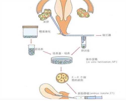 上海找代孕中介_上海代孕官网_三个月可以听胎心吗