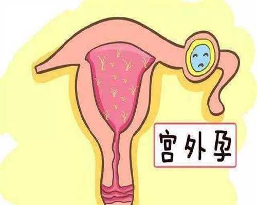 上海代孕价格详细说明_上海代孕医院怎么联系_儿童学围棋的最佳年龄