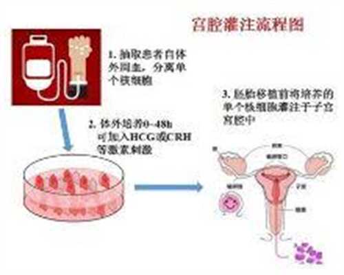 上海代孕包成功靠谱吗_上海正规代孕医院价格表_胎儿营养不良的表现是什么