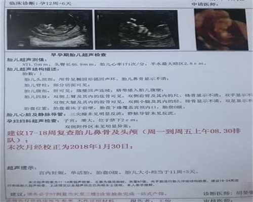 上海代孕医院排名_上海代孕中介一条龙_如何教育乱抓东西的宝宝