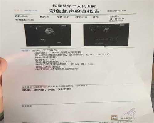 上海供卵违法吗_上海哪家供卵试管婴儿最好_孕妇可以在五月看电影吗