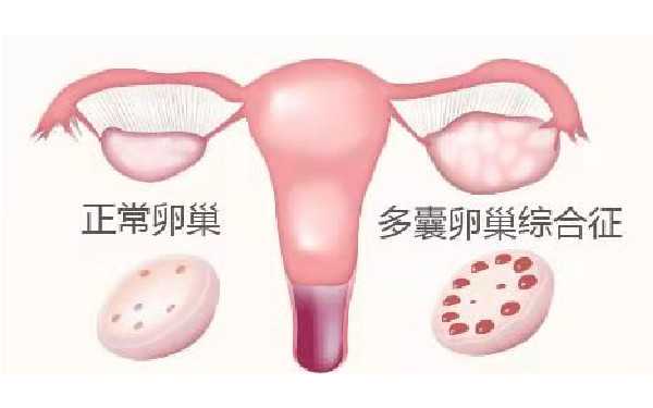 有愿意上海私人助孕的吗 上海瑞金医院介绍 ‘怀女儿跟怀儿子b超区别’