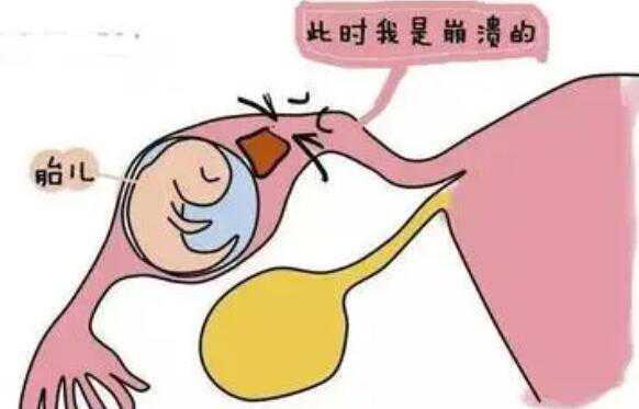 上海供卵助孕包男孩 上海
