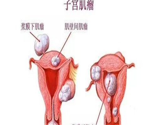 不射精不育
