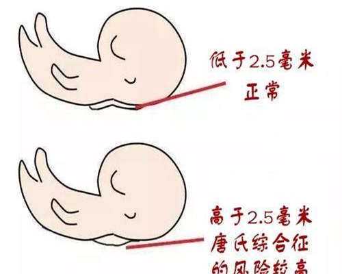 不孕不育治疗费用